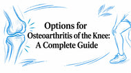 Options for Osteoarthritis of the Knee: A Complete Guide